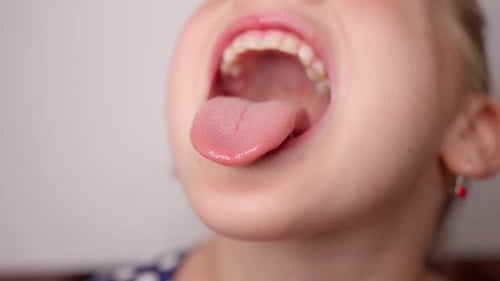 Girl Opens Her Mouth Wide and Pulls Out Long Tongue Child Shows His Teeth and Mouth to Dentist Mouth