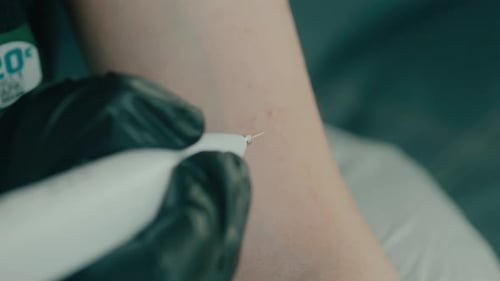 Arm Receives Skin Treatment with Special Tool