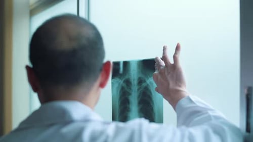 Doctor Analyzing Chest X-ray in Hospital Setting