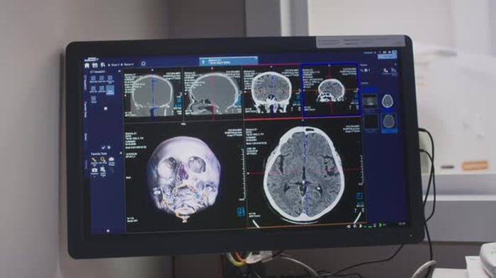Digital Brain MRI Scan Displayed on Screen in Clinic, Medical Stock ...