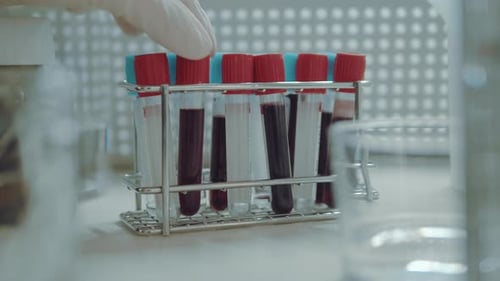 Blood Samples in Vials Rack in Bright Lab