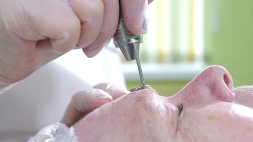 Medical Drill Used in Clinical Procedure