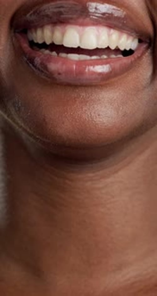 Happy, smile and dental with lips of woman in studio for oral hygiene, orthodontics and veneers