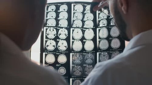 Neurologists Looking at MRI Scan Discussing Treatment Plan at Workplace