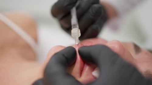 Cosmetic Injection Procedure on Lips in Close Up