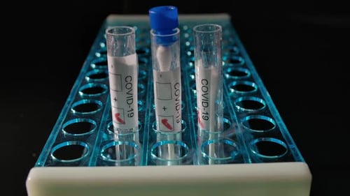 Close up of COVID-19 Test Tubes in Hospital