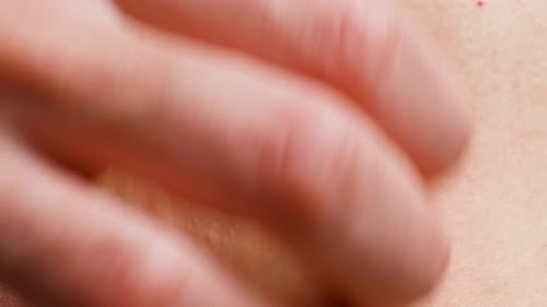 Finger Scratches Irritated Skin in Extreme Close Up