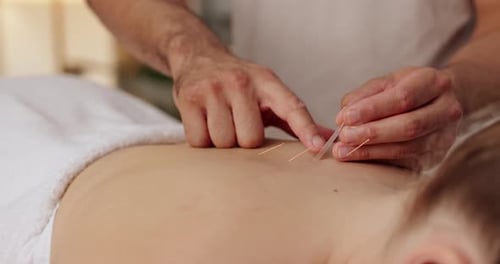 Femme, gros plan et dos avec aiguille d'acupuncture pour massage, médecine alternative