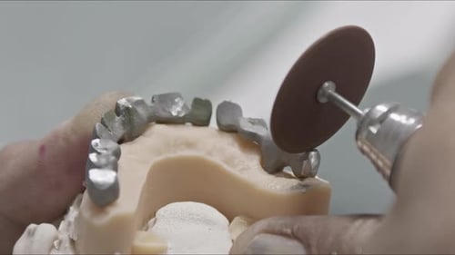 Close Up of Dental Implants Being Ground