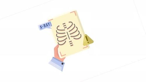 X-Ray Rib Scan Animated Icon – Medical Diagnostic Illustration