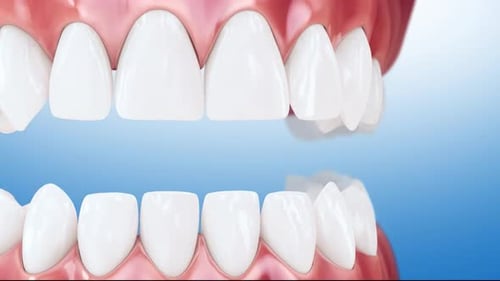 Perfect white teeth with healthy gums on blue background