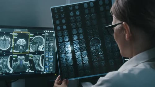Woman Doctor Reviewing Patient Brain Scan in Hospital