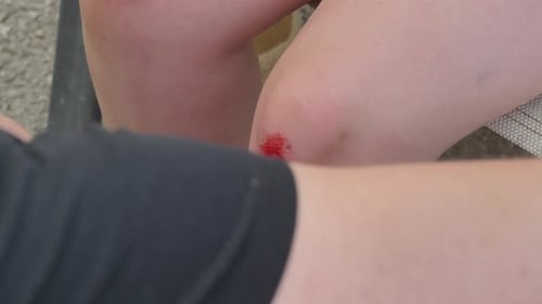 Cleaning and Bandaging a Knee Scrape Outdoors