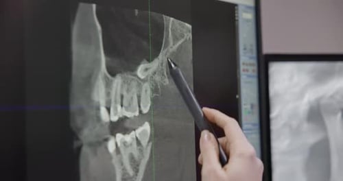 Radiologist Dentist Doctor Looking at Teeth 3D Xray On Desktop Computer Monitor