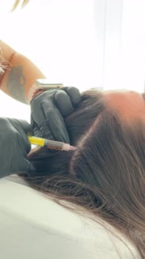 Closeup of a Cosmetic Procedure Trichology Specialist Performs Scalp Mesotherapy Injection to