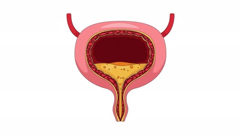 Animated Bladder Icon Showing Urinary Incontinence, Backgrounds Motion ...