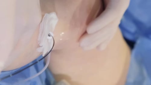 Enlarged Plan of a Patient's Leg During Surgery for Varicose Veins Leg Problems Vertical Video