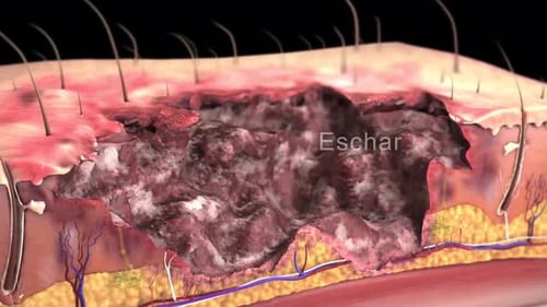 Close-up of human knee with injury or inflammation