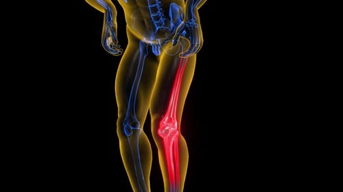 3D Human Anatomy Scan Highlighting Knee Pain and Skeleton