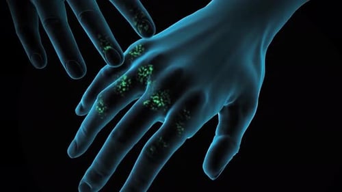 3D Animated Medical Illustration of Germs, Infection, and Healing