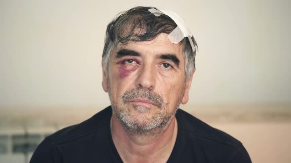 alcoholic after fight in a bar stares at the camera, People Stock ...