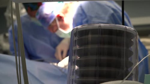 Anästhesieassistenten verwenden auch eine Anästhesie unter direkter Aufsicht eines Arztes in Anästhesie