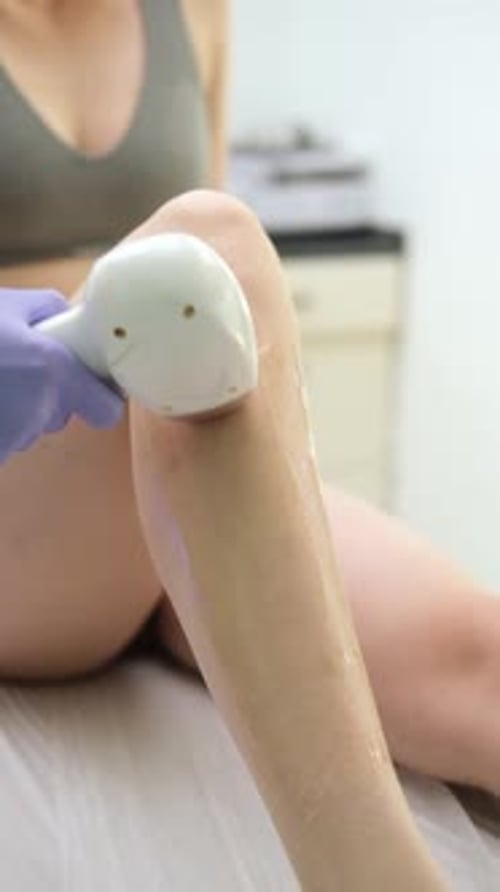 Woman receiving laser hair removal treatment on her leg