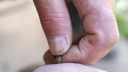 Removing a Bee Stinger Close-Up