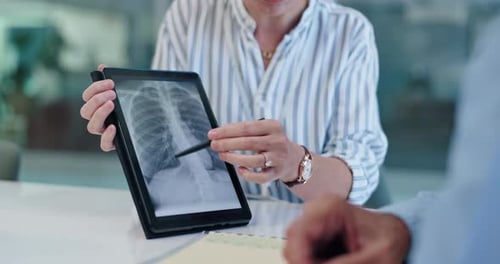 Doctor, tablet and xray discussion in office with lung anatomy, surgery planning