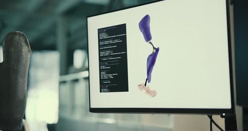 Computerbildschirm, Forscher und Person mit Prototyp im Prothetikbüro für Beinprothesen