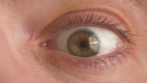 Man Looks in Different Directions for External Inspection of Eye Injuries Closeup Medical