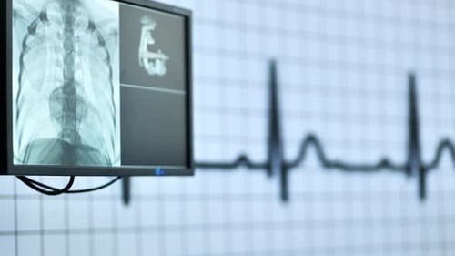 Doctor Analyzing Xray Images on Monitor Discussing Medical Diagnosis with Colleagues