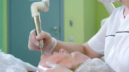 Resurfacing Facial Skin with Laser Modern Innovative Medical Equipment Laser Face Polishing in