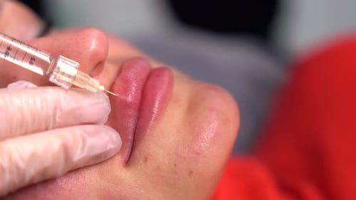 Lip Filler Injection Beauty Treatment Close-Up