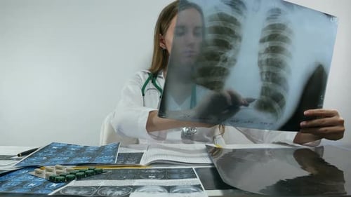 Female Doctor Works With A Lung X Ray