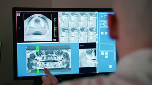 numérisation des dents sur une radiographie de la mâchoire d'un patient sur un écran d'ordinateur (mise à l'échelle de la dentition)