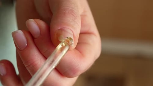 Closeup of a Woman Applying Healing Oil to a Damaged Detached Nail Onycholysis