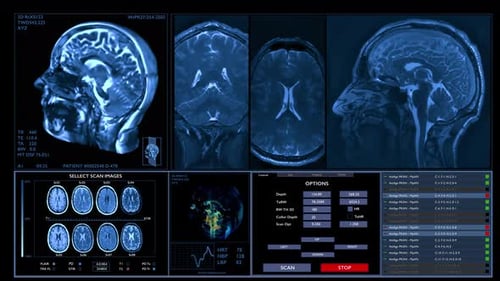 MRI Brain Scanning Animation