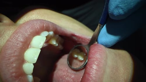 Dental Care Extreme Close Up Macro Video Dentist Treat Patient Teeth Orthodontist Works with