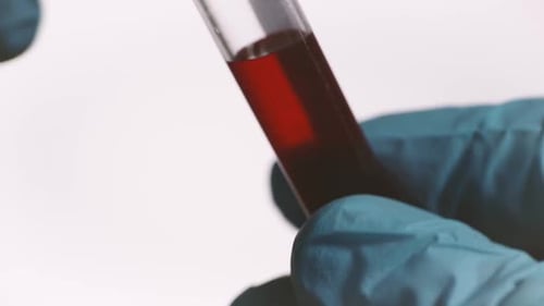COVID-19 Positive Blood Sample in Test Tube