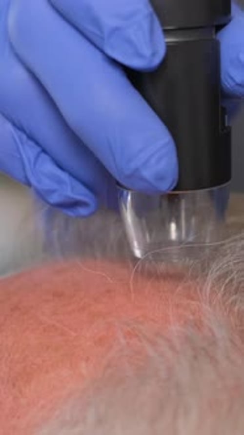 A Trichologist Conducts a Detailed Hair Diagnosis and Examination of an Older Man Vertical Video