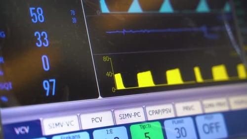 Close up of ECG, medical vital signs monitor in hospital 4K