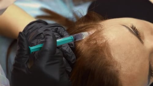 Woman Receiving Scalp Injection Close Up