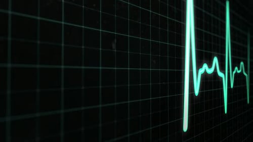 Heartbeat Measurement on a Medical Monitor with Green Lines and Grid Pattern