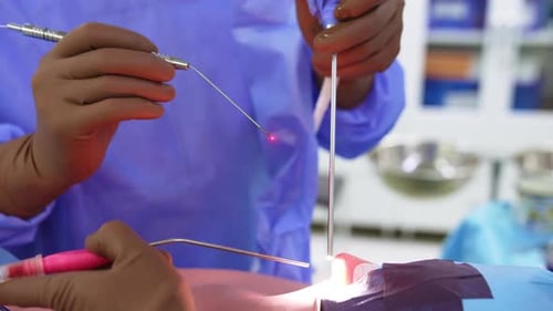 HNO-Nasenoperation in Aktion. Das Chirurgenteam führt Spezialwerkzeuge in die Nase des Patienten ein
.