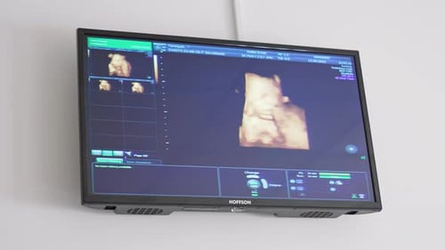 Ultrasound baby in a mother's womb. Ultrasound of pregnant woman. Scientific analysis