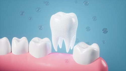 3D Animated Tooth Implant Replacement