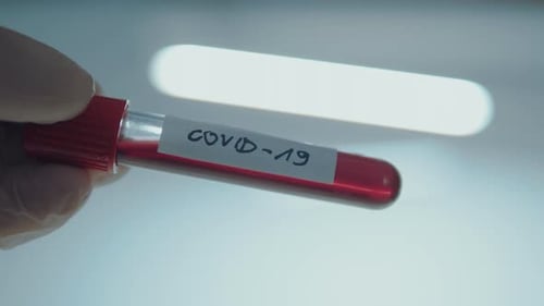 Gloved Hand Holds COVID-19 Blood Sample Close Up