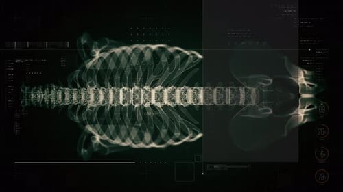 Biotech X-ray view of ribcage and thoracic spine