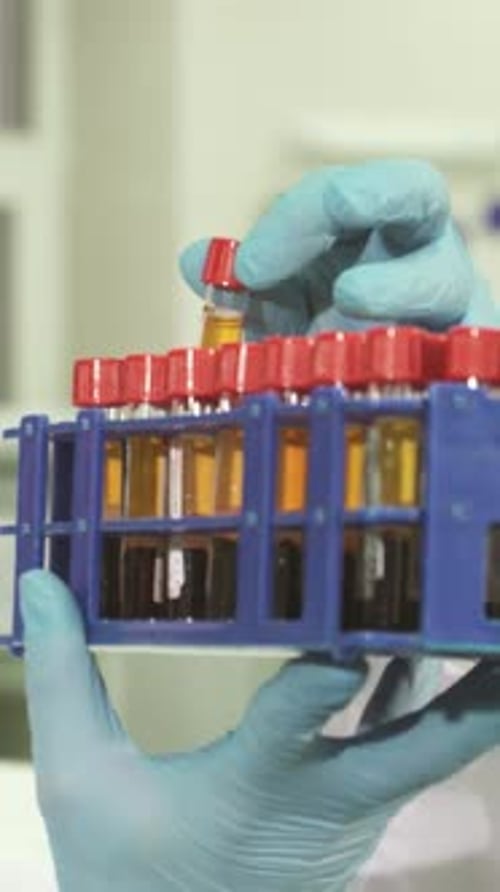 Hands Holding Test Tubes With Blood Samples